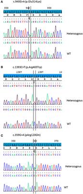 Aberrant Splicing Is the Pathogenicity Mechanism of the p.Glu314Lys Variant in CYP11A1 Gene